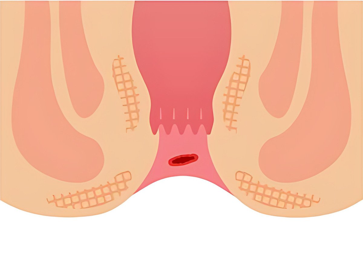 ragada-diagramma-hd